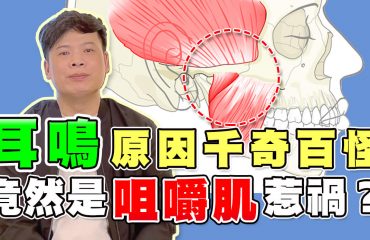 咀嚼肌造成耳鳴-影片封面